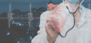 Doenças do Miocárdio e do Pericárdio